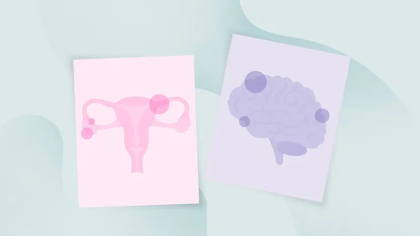 PCOS and Migraine: What’s the Connection?